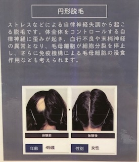 メニューの写真